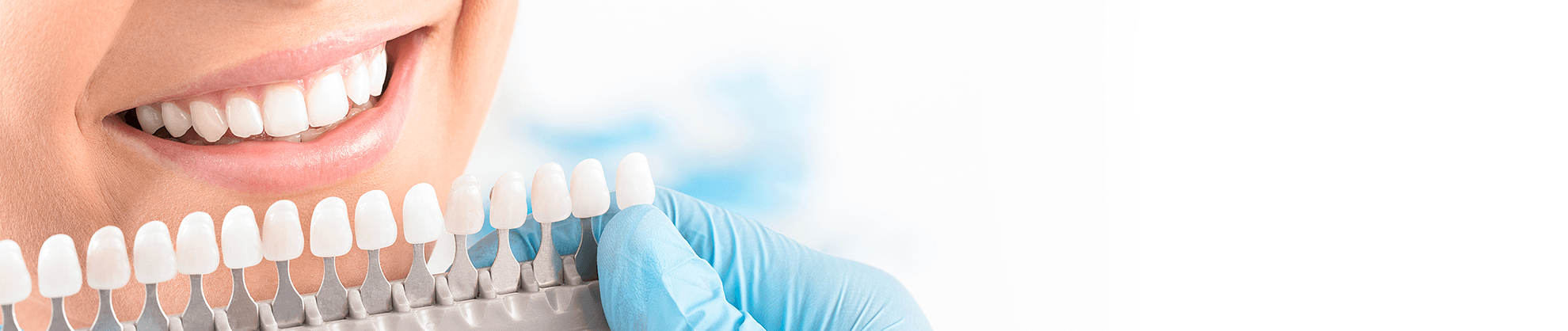 Veneers in Windermere, Florida